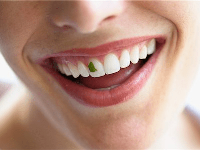 If you noticed that a stranger had food in their teeth, would you tell them?